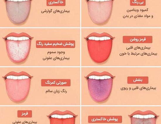 عکس زبان کودک سالم