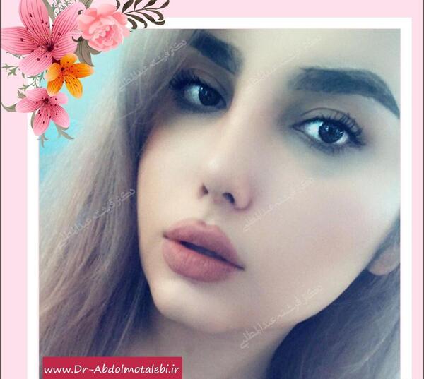هزینه عکس آتلیه برای جراحی بینی