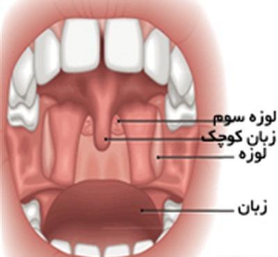 عکس گلوی سالم کودک