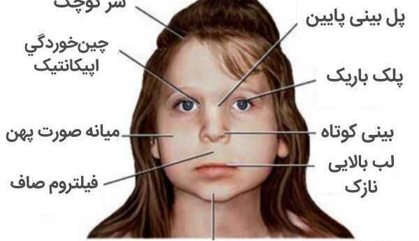 عکس از کودک بیش فعال