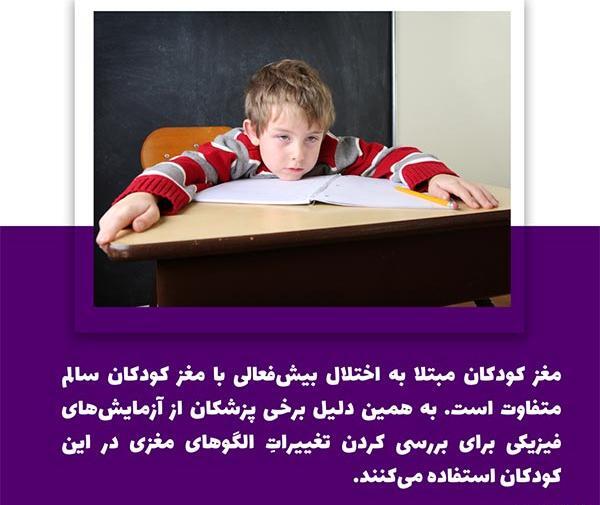 عکس مغز کودک بیش فعال