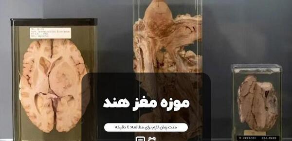 نوزاد ترسناک عکس مغز انسان واقعی