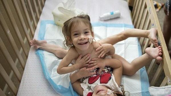 عکس لاله و لادن دوقلوهای به هم چسبیده