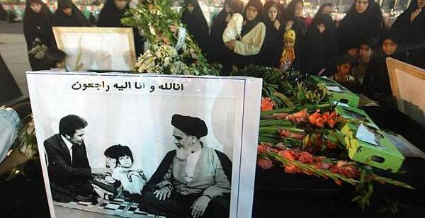 عکس لاله و لادن قبل از عمل