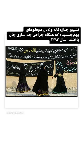 عکس لاله و لادن قبل از عمل