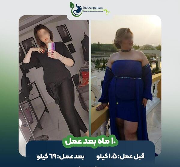 عکس قبل عمل دیانا دادمهر