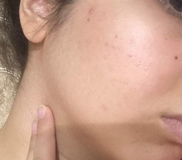 عکس گلو نی نی سایت
