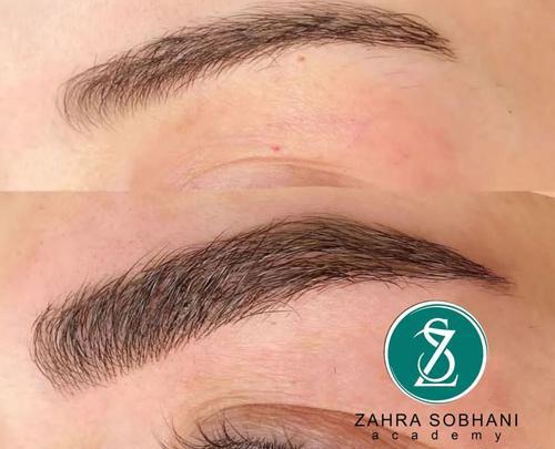 عکس فیبروز تاج ابرو