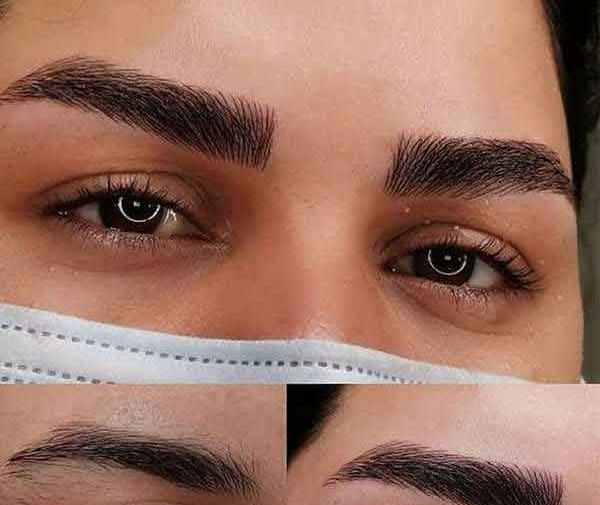 عکس فیبروز تاج ابرو