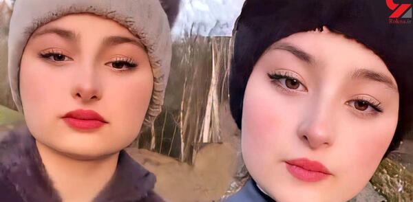 عکس عمل بینی نیکا فلاحی