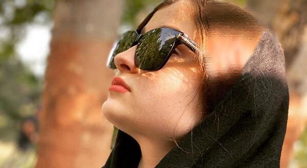 عکس عمل بینی نیکا فلاحی