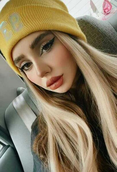 عکس عمل بینی نیکا فلاحی