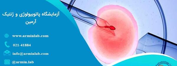ایده عکس فریز شده