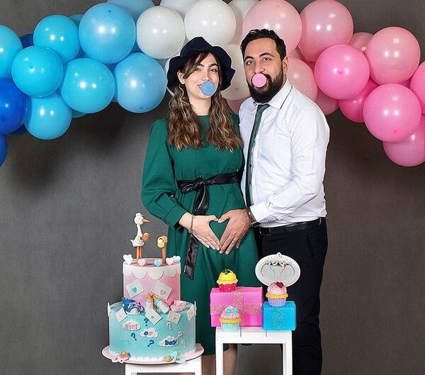 ایده عکس سونو