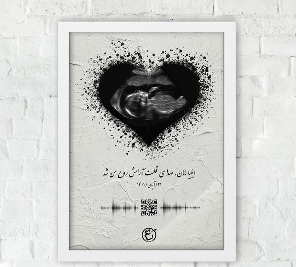 ایده قاب عکس سونوگرافی
