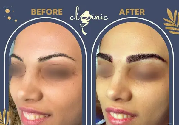 عکس مدل های کاشت ابرو