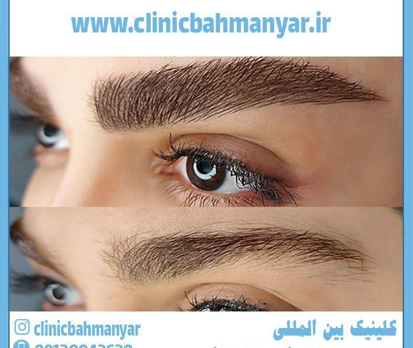 عکس مدل های کاشت ابرو
