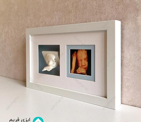 ایده قاب عکس نوزاد
