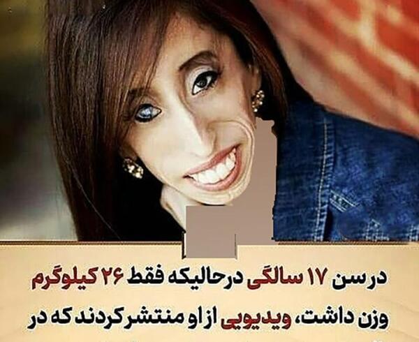 عکس زشت ترین دختر توی جهان
