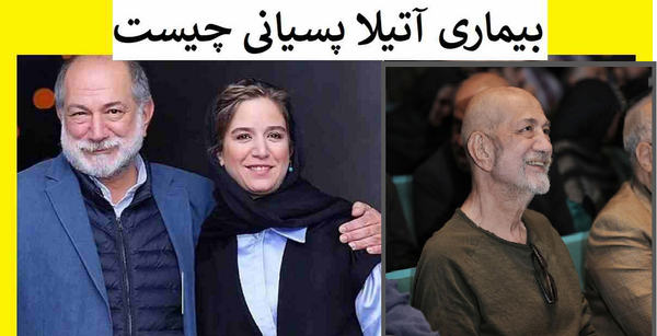 عکس آتیلا پسیانی سرطان