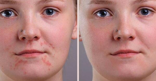 فتوشاپ عکس صورت روی بدن دیگر