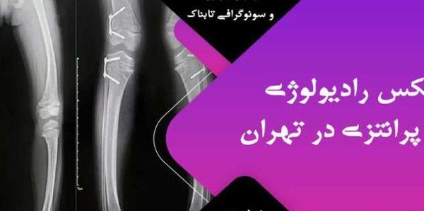 عکس جوینت