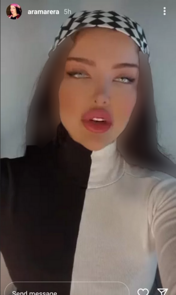 عکس آرام جوینده قبل از عمل