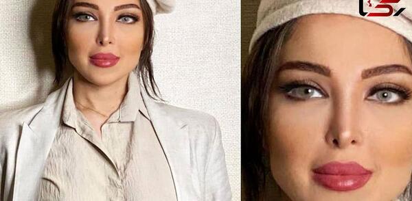 عکس آرام جوینده قبل از عمل