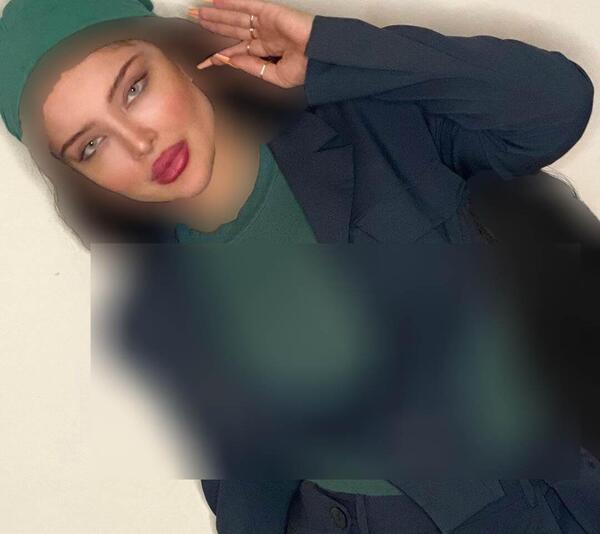 عکس آرام جوینده قبل از عمل