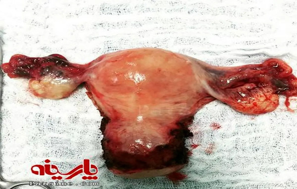 عکس واقعی بویونگ