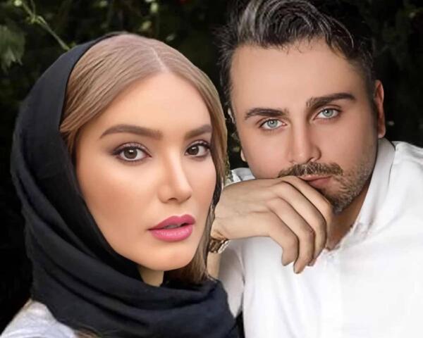 عکس جونگ کوک قبل از عمل زیبایی