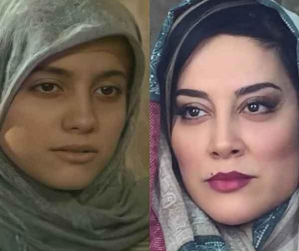 عکس جونگ کوک قبل از عمل زیبایی