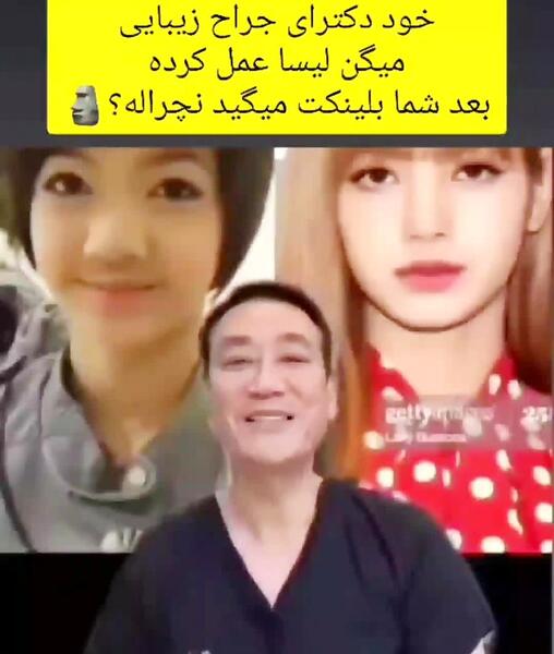 عکس زشت از لیسا