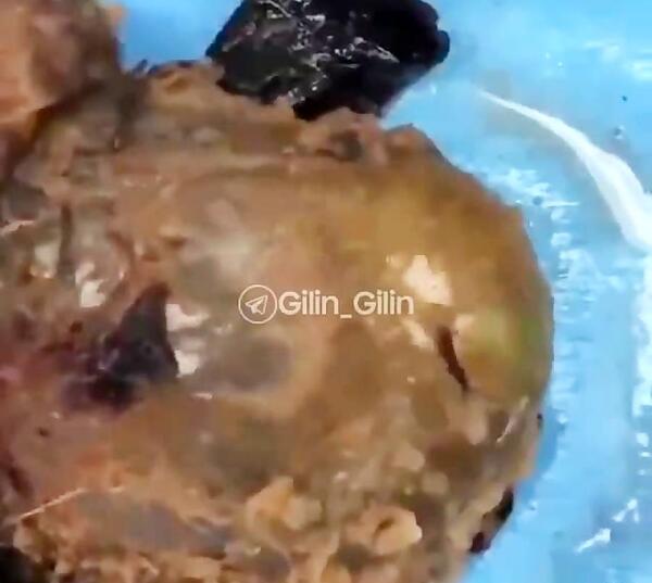 عکس جنین سقط شده سه ماهه دختر