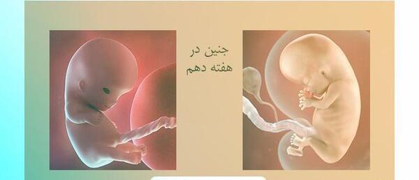 عکس جنین سقط شده دو ماهه دختر