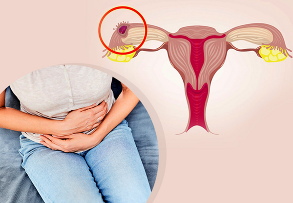 عکس جنین سقط شده یک ماهه دختر