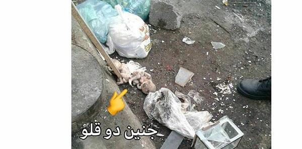 عکس جنین یک ماهه که سقط شده