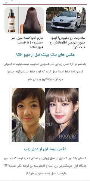 عکس قبل از عمل جیسو