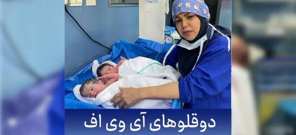 دوقلو عکس بچه های ای وی اف