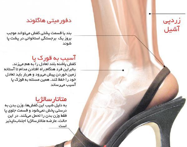 عکس بلندترین پاشنه ی کفش جهان