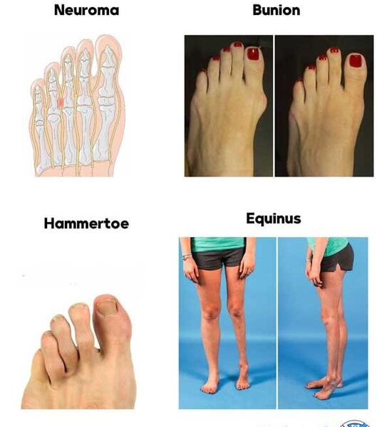 عکس پای زن با کفش پاشنه بلند