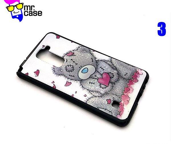 عکس قاب گوشی ال جی