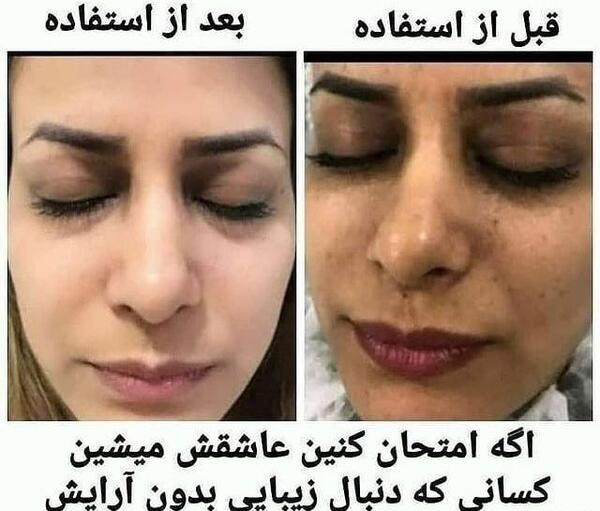 عکس کرم وی ای پی اصل