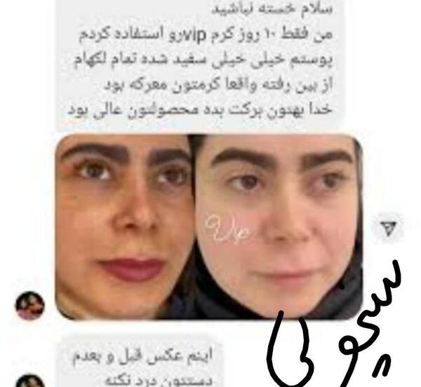 عکس کرم وی ای پی