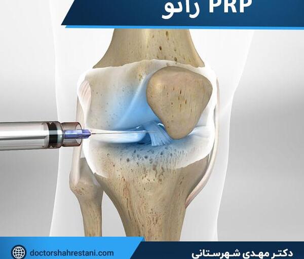 عکس پی آر پی