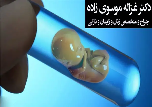 عکس امپول ای وی اف