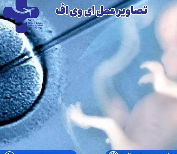 عکس دستگاه ای وی اف