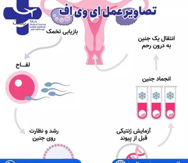عکس دستگاه ای وی اف