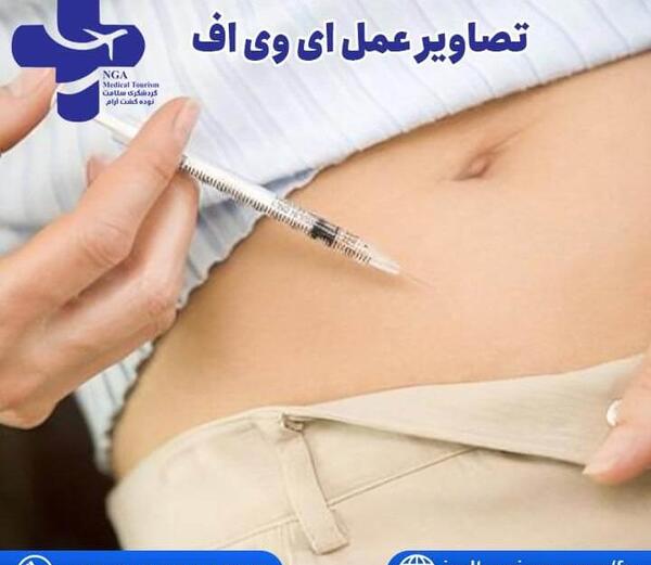 عکس دستگاه ای وی اف