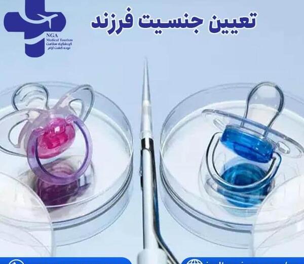 عکس دستگاه ای وی اف